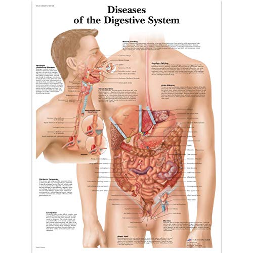 3b naučni VR1431UU sjajni papir bolesti probavnog sistema anatomska Tabela, veličina postera 20 Širina x